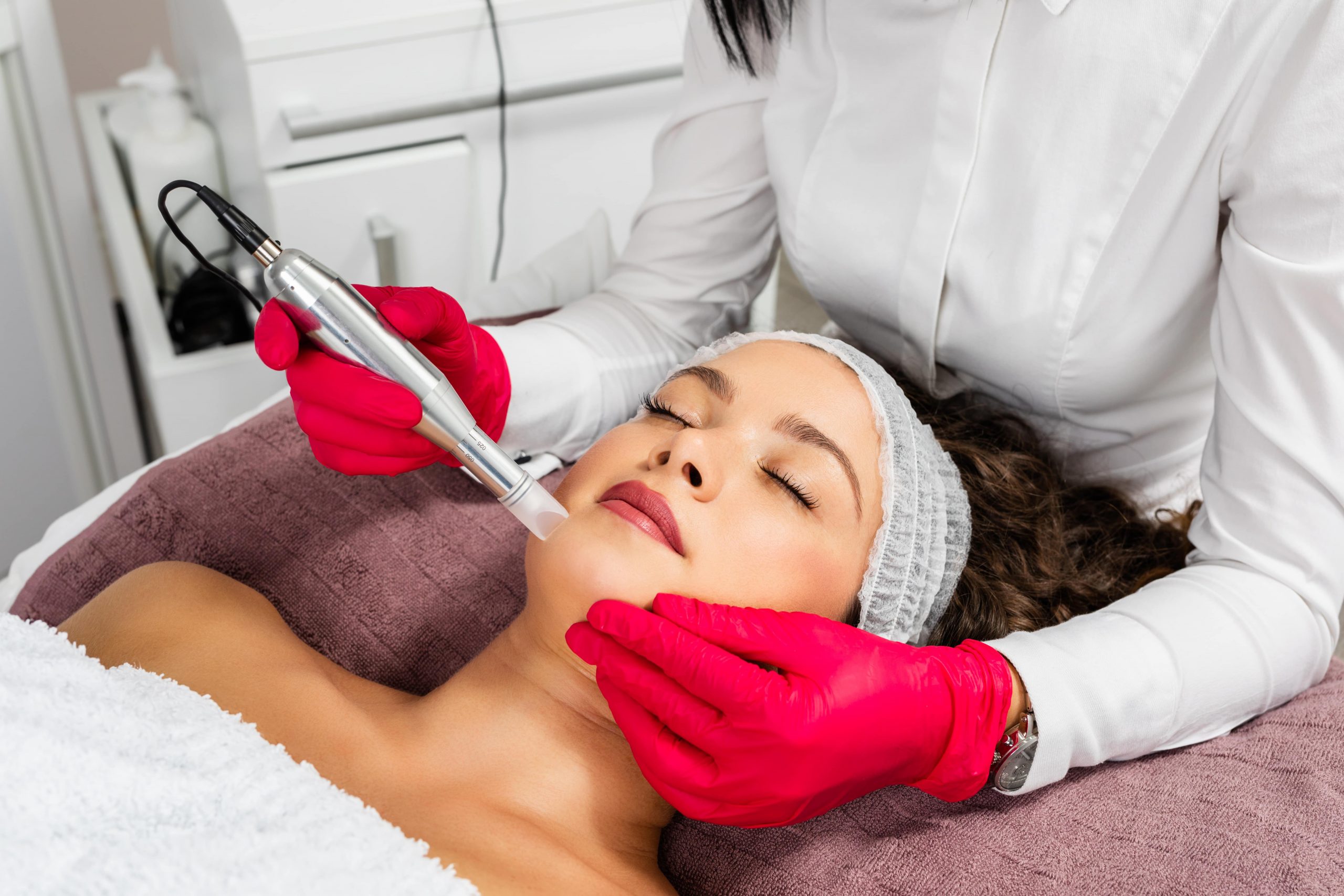 RF Microneedling in Bronx, NYC - A.Maks Aesthetics